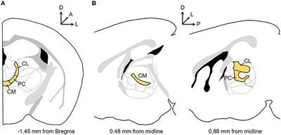 Rostral Intralaminar Thalamus Engagement in Cognition and Behavior